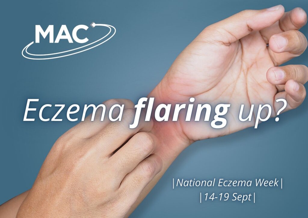 Why is my eczema flaring up? MAC Clinical Research