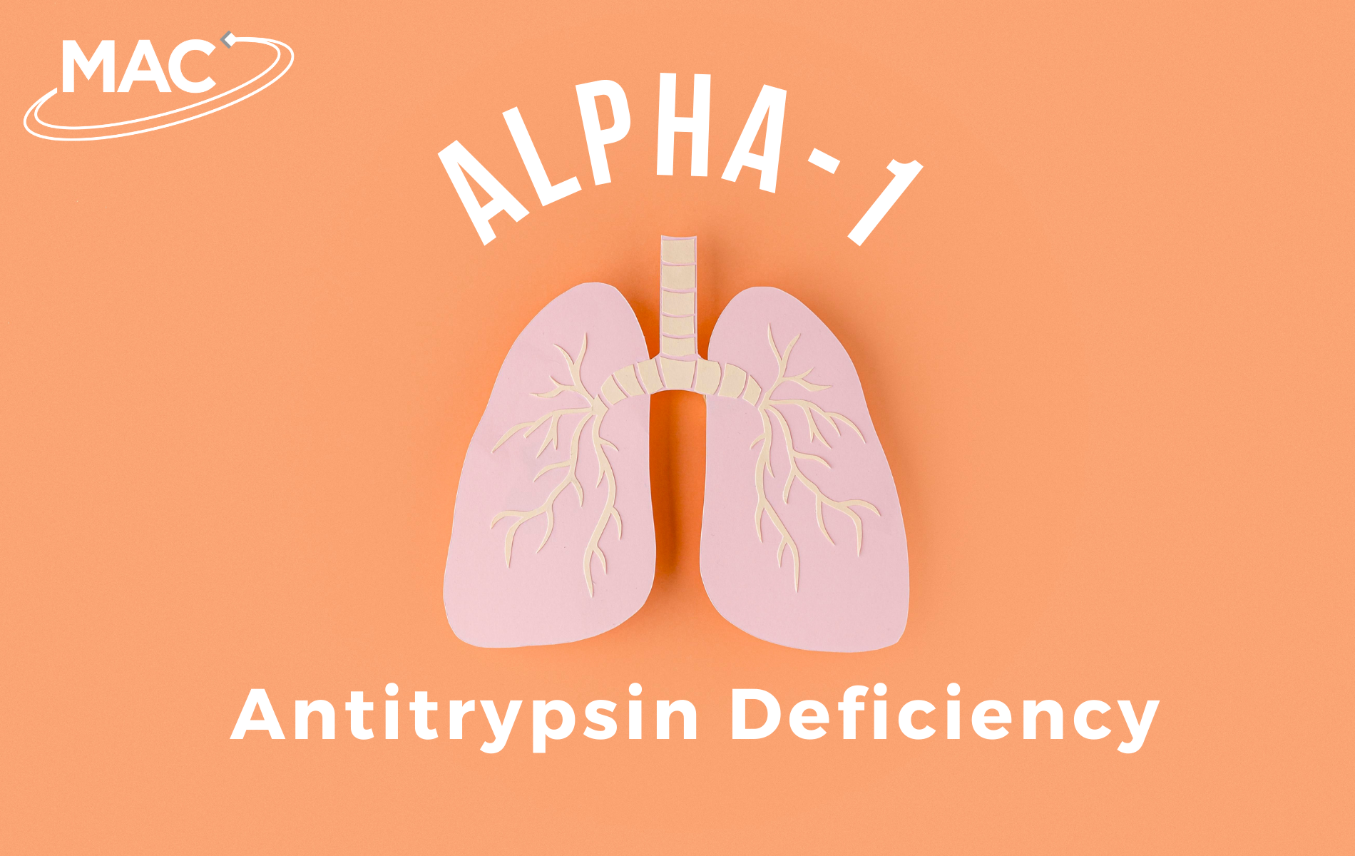 Alpha-1 antitriptysin deficiency