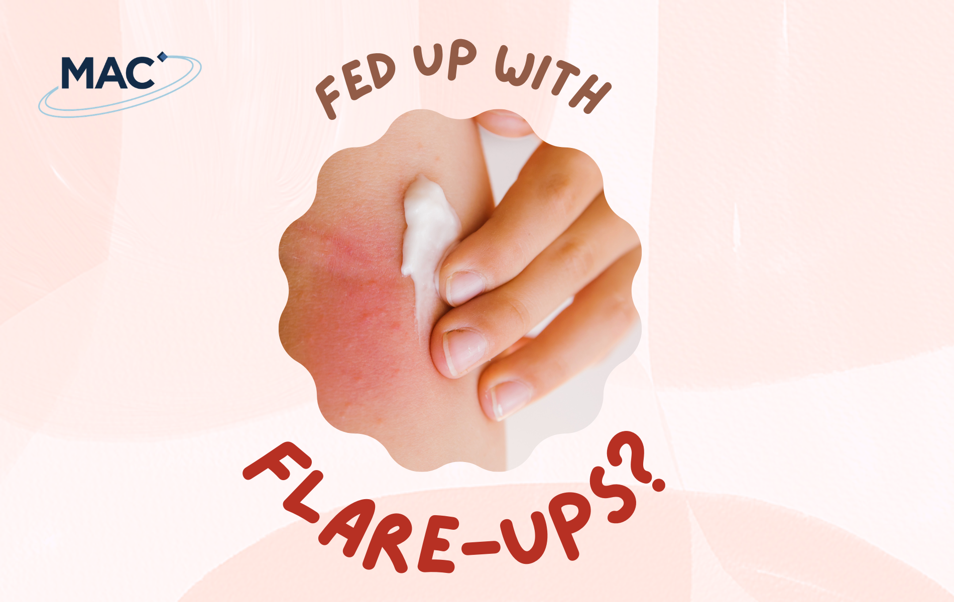 Eczema clinical trial at MAC