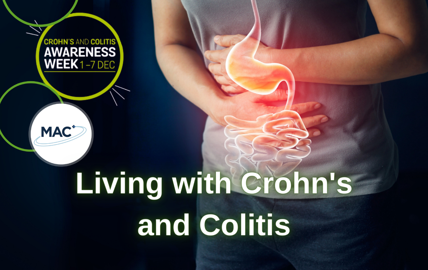 living with crohns and colitis
