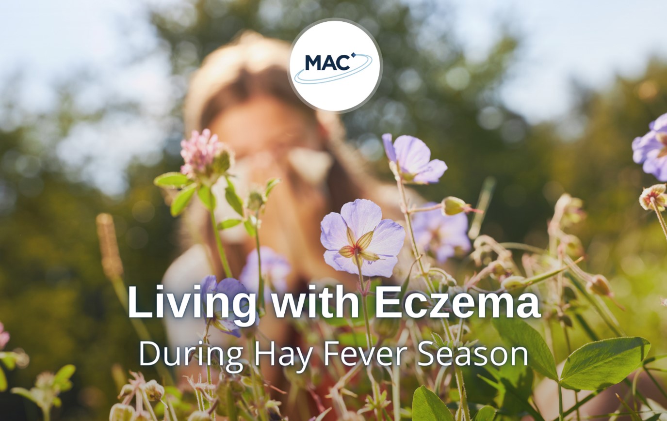 Living with eczema during hay fever season
